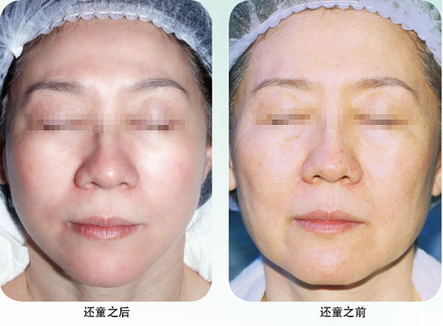 风险久久久久久亚洲精品影院