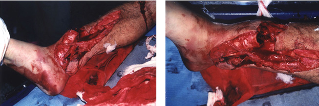 风险久久久久久亚洲精品影院