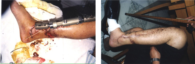 风险久久久久久亚洲精品影院