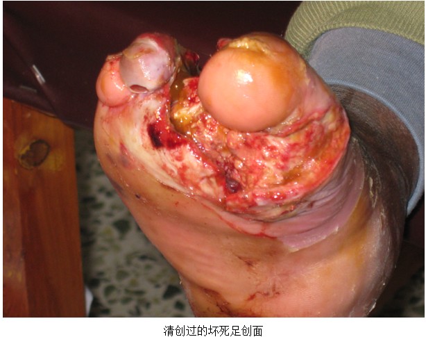 风险久久久久久亚洲精品影院