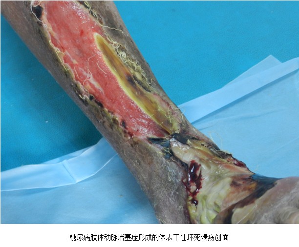 风险久久久久久亚洲精品影院